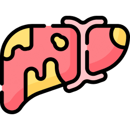 Higado graso